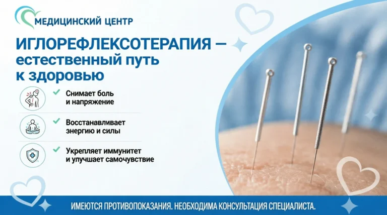 800 точек на пути к здоровью: как работает иглорефлексотерапия?