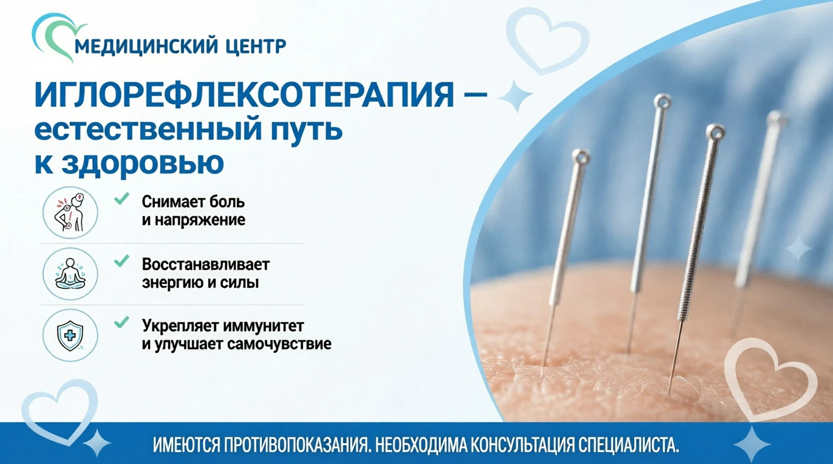 800 точек на пути к здоровью: как работает иглорефлексотерапия?